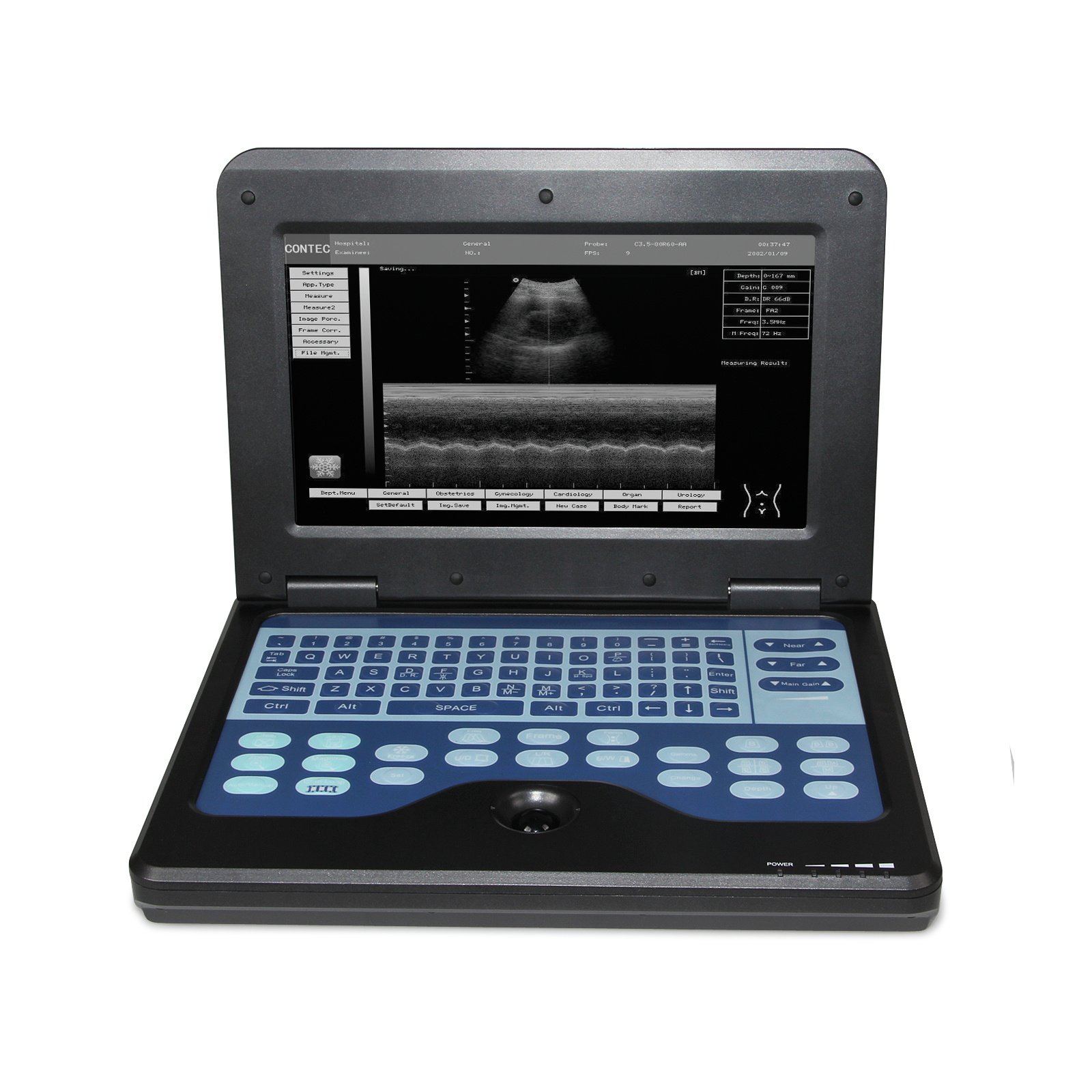 5f2a556c-b99c-4cd5-86ae-54bd17138141.jpg Portable Ultrasound Scanner Laptop Digital Diagnostic Machine 3.5 Convex Probe - Image 1